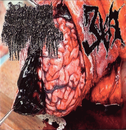 Human Pancake : Human Pancake - 3XA